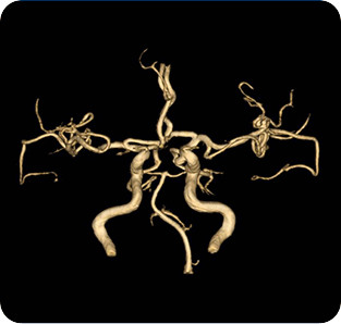 <신가병원 MRI 뇌혈관 영상>